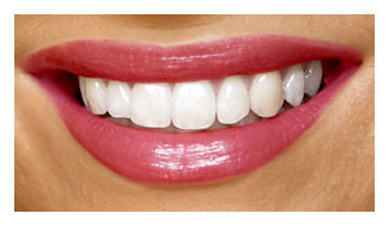 Impantologie, Aestheiche Zahnmedizin